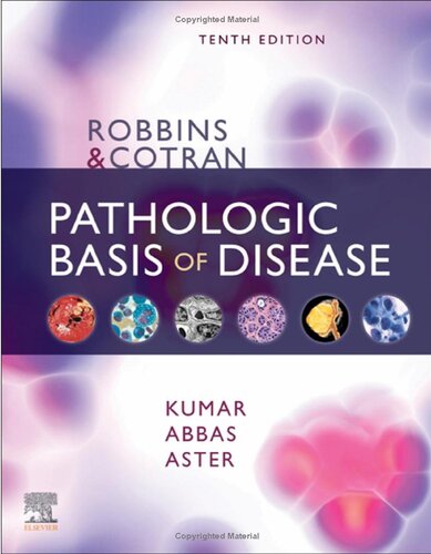 Robbins & Cotran Pathologic Basis of Disease 10th Edition PDF